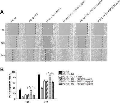 Fibroblast Growth Factor 22 Inhibits ER Stress-Induced Apoptosis and Improves Recovery of Spinal Cord Injury